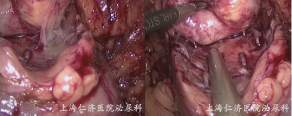 1693966909340226.png 图片85.png