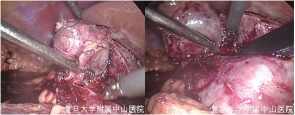 1693966989443041.png 图片93.png