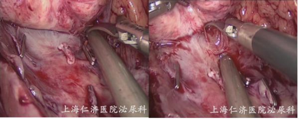 1693967006105984.png 图片95.png