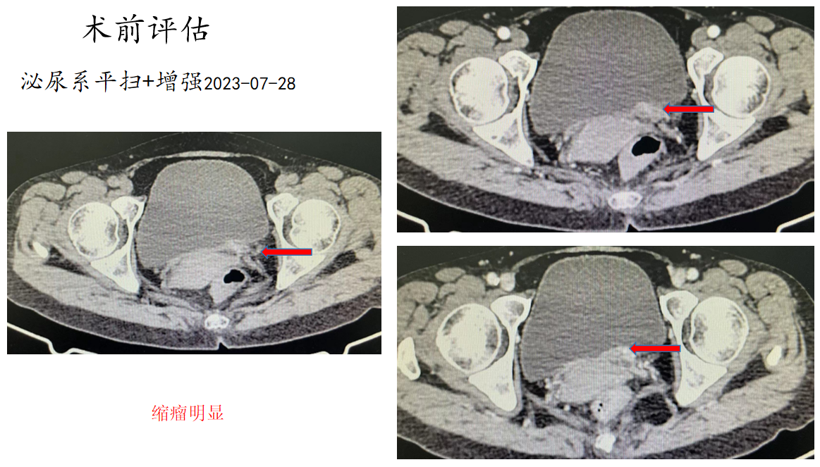 1703579696210784.png 微信图片_20231226163425.png
