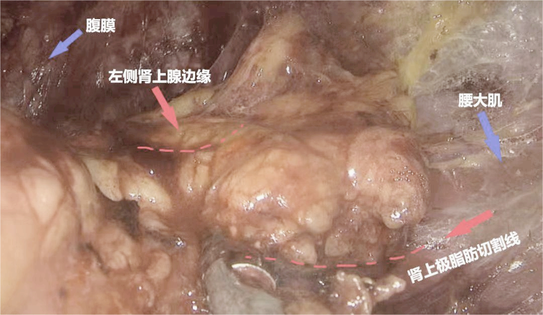 1708585049698510.png 微信图片_20240222145713.png