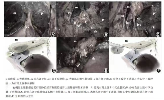 1708585083862815.png 微信图片_20240222145751.png