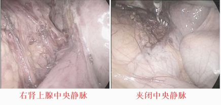 1708585130914271.png 微信图片_20240222145839.png