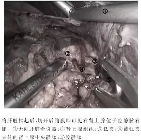 1708585147993997.jpg 微信图片_20240222145854.jpg