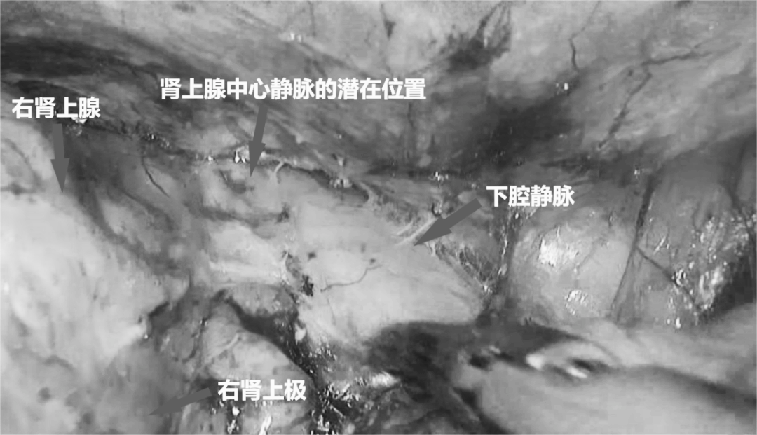 1708585168551704.png 微信图片_20240222145912.png