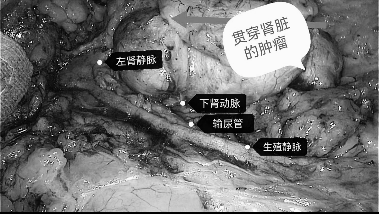 1708585229533372.png 微信图片_20240222150016.png