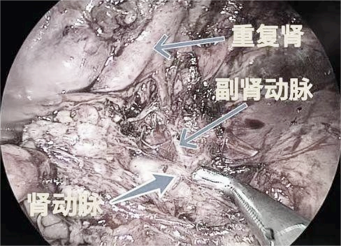 1708585267698856.png 微信图片_20240222150056.png