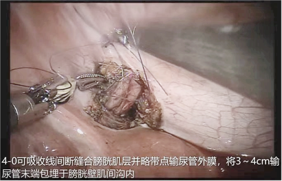 1708587449316081.png 微信图片_20240222153718.png