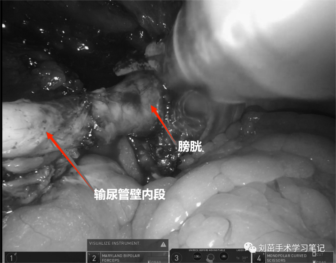 1708588576848034.png 微信图片_20240222155602.png