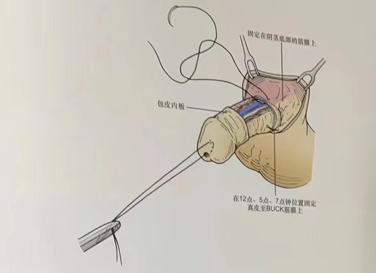 1709525915960367.jpg c3d93f51f7f3e77abfd0455460f97ab.jpg