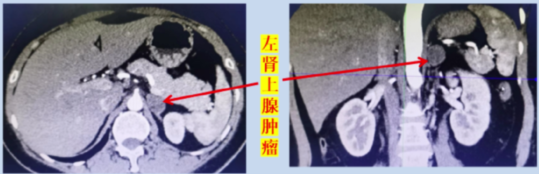 1714270745583557.png 微信图片_20240428101852.png