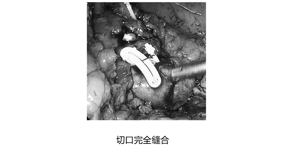 1720769100755906.png 微信图片_20240712152447.png