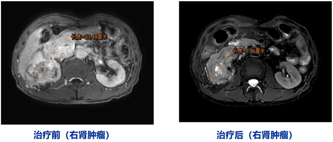 1727664447742557.png 微信图片_20240930104718.png