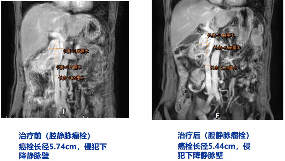 1727664462883138.png 微信图片_20240930104733.png