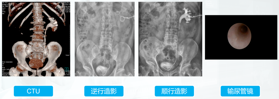 1744859496332313.png 微信图片_20250417111122.png