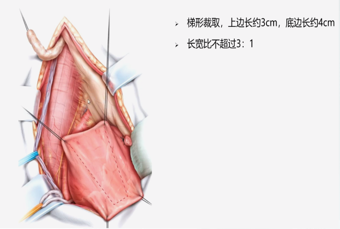 1744859913955664.png 微信图片_20250417111811.png