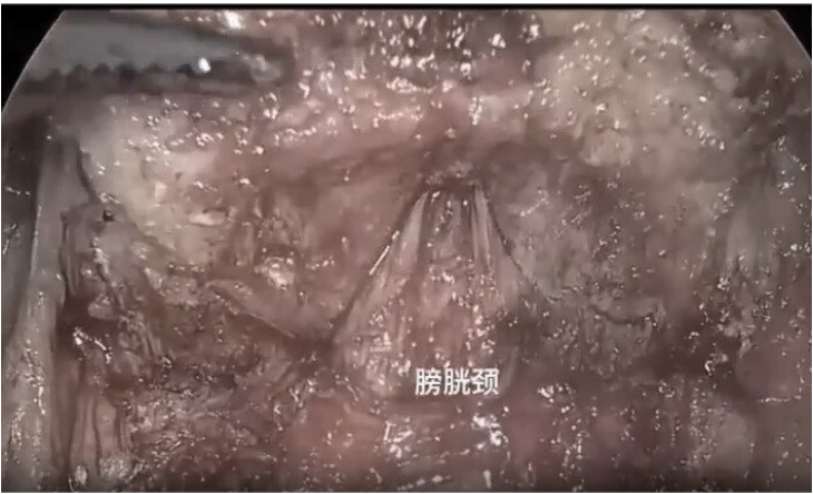 1747375283115068.png 微信图片_20250516113745.png