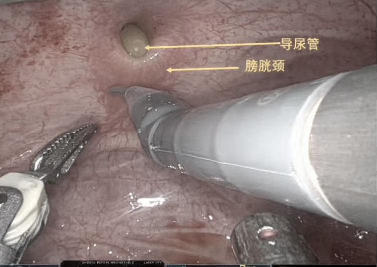 1747375299366877.png 微信图片_20250516113807.png