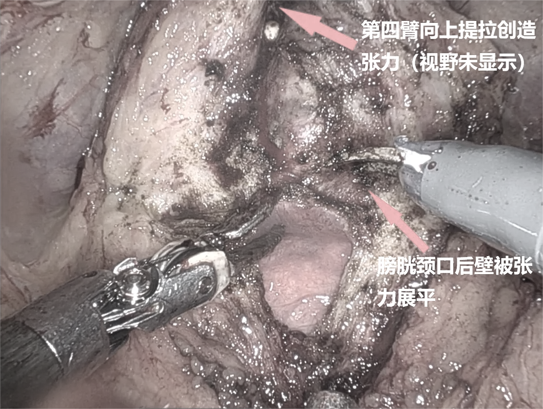 1747377064908621.png 微信图片_20250516143055.png
