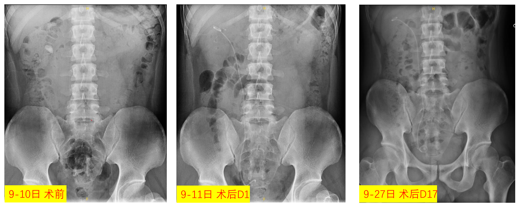 1747727646713022.png 微信图片_20250520155355.png