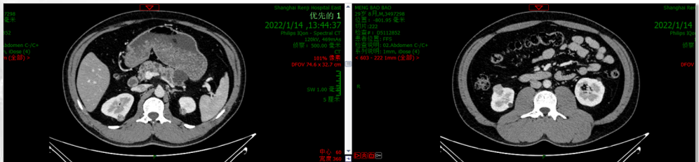 1748586885234995.png 微信图片_20250530143436.png