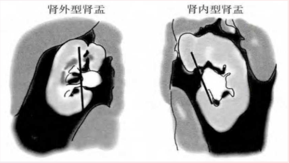 1754989252176781.png 微信图片_2025-08-12_170035_205.png