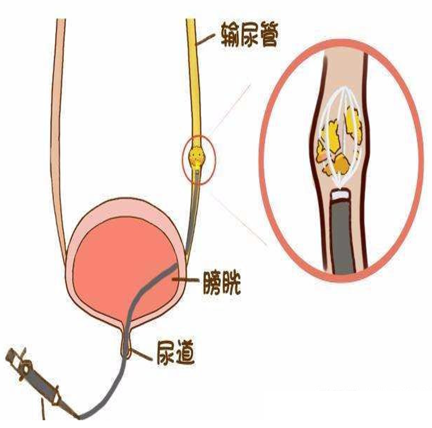 1757400542358809.png 微信图片_2025-09-09_144844_107.png