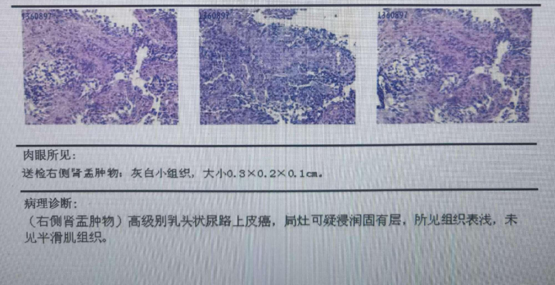 1758617125159702.png 微信图片_2025-09-23_164511_872.png