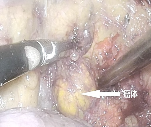 1758700219356574.png 微信图片_2025-09-24_155005_548.png