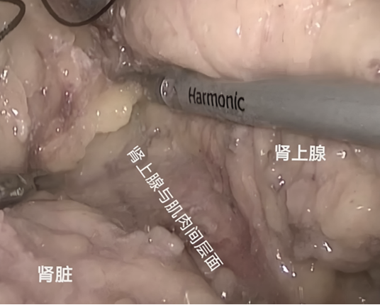 1758700239266119.png 微信图片_2025-09-24_155021_954.png