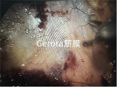 微信图片_2026-04-23_111350_919.png