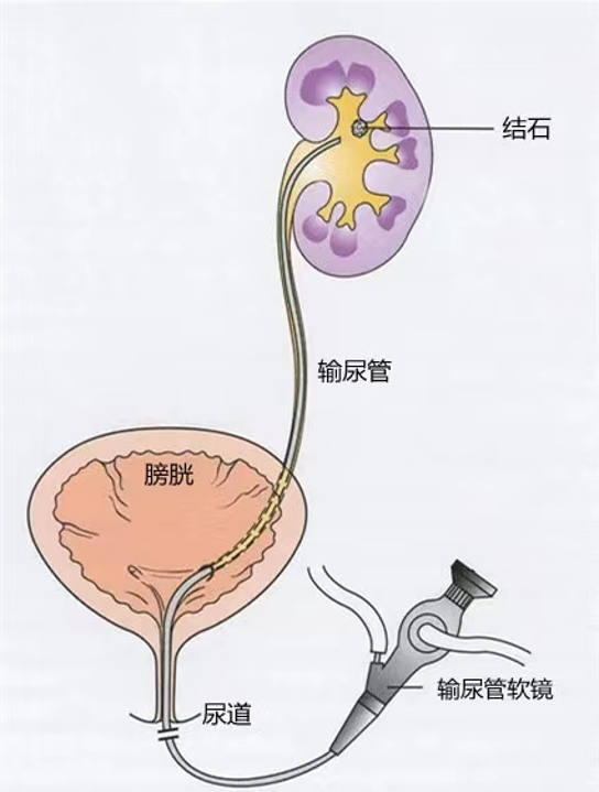 1783394538736864.png 微信图片_2026-07-07_112010_300.png