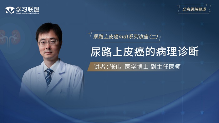 第379期 张伟 | 尿路上皮癌的病理诊断