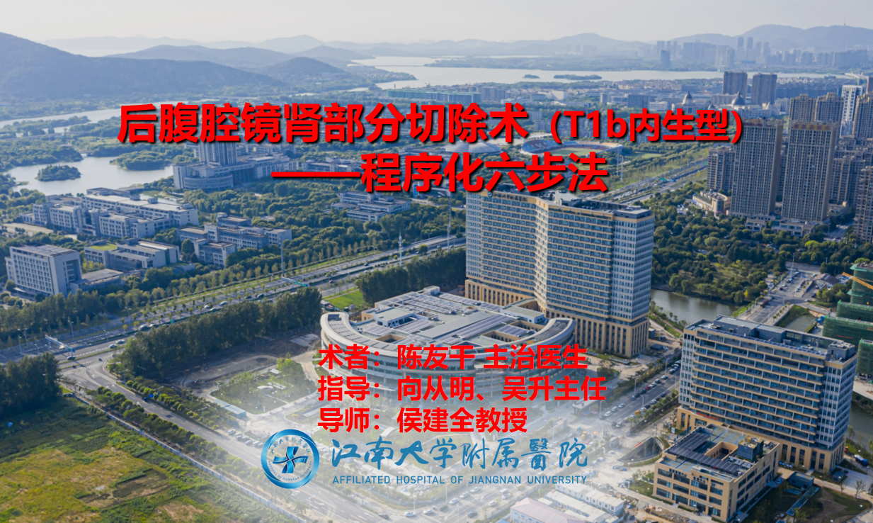 后腹腔镜肾部分切除术（T1b内生型） ——程序化六步法