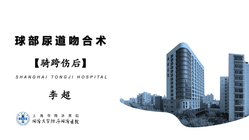 球部尿道吻合术【骑跨伤后】