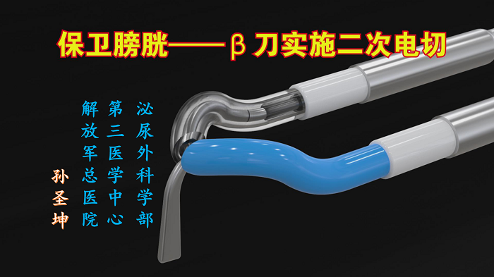 保卫膀胱——β刀实施二次电切