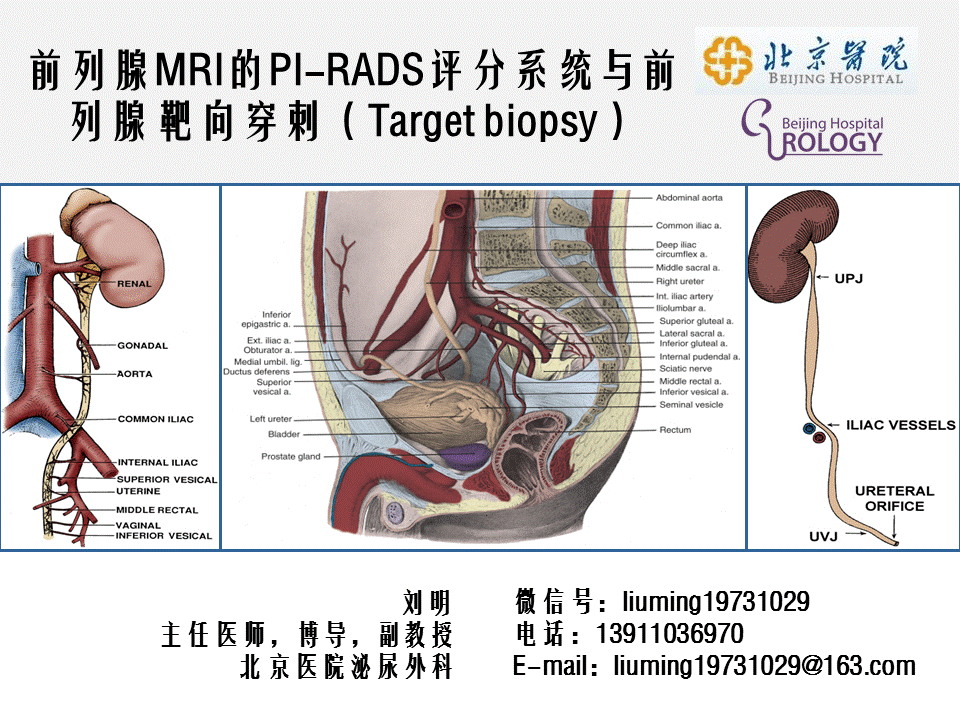 第56期 前列腺癌影像诊断和靶向穿刺，新技术还是新观念？北京医院第4期