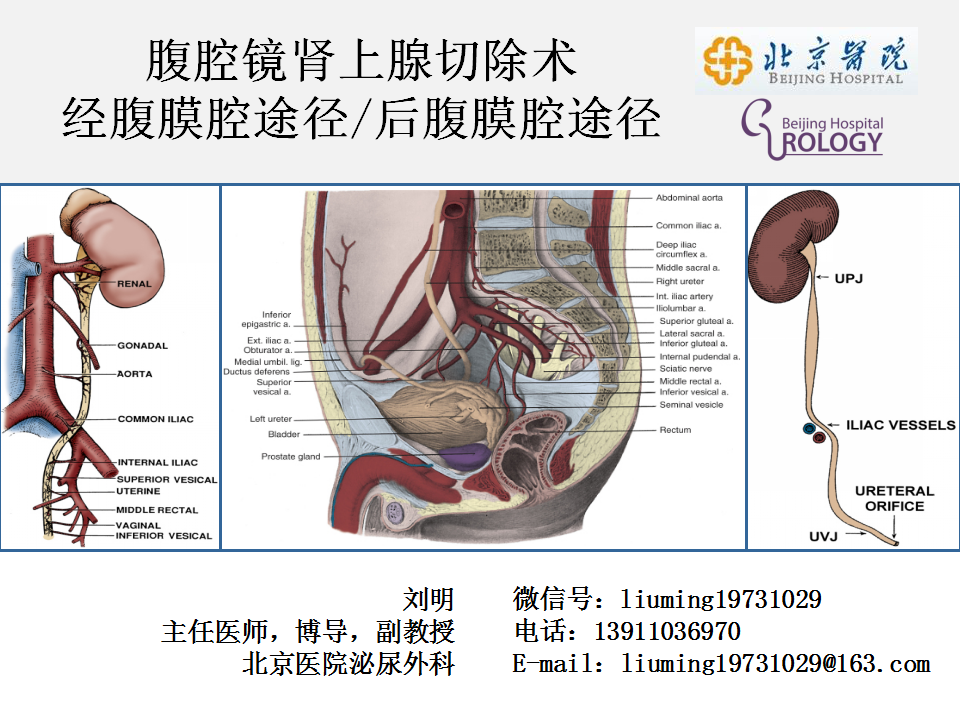 第97期 经腹腔途径和经后腹膜腔途径腹腔镜肾上腺手术 北京医院频道第11期