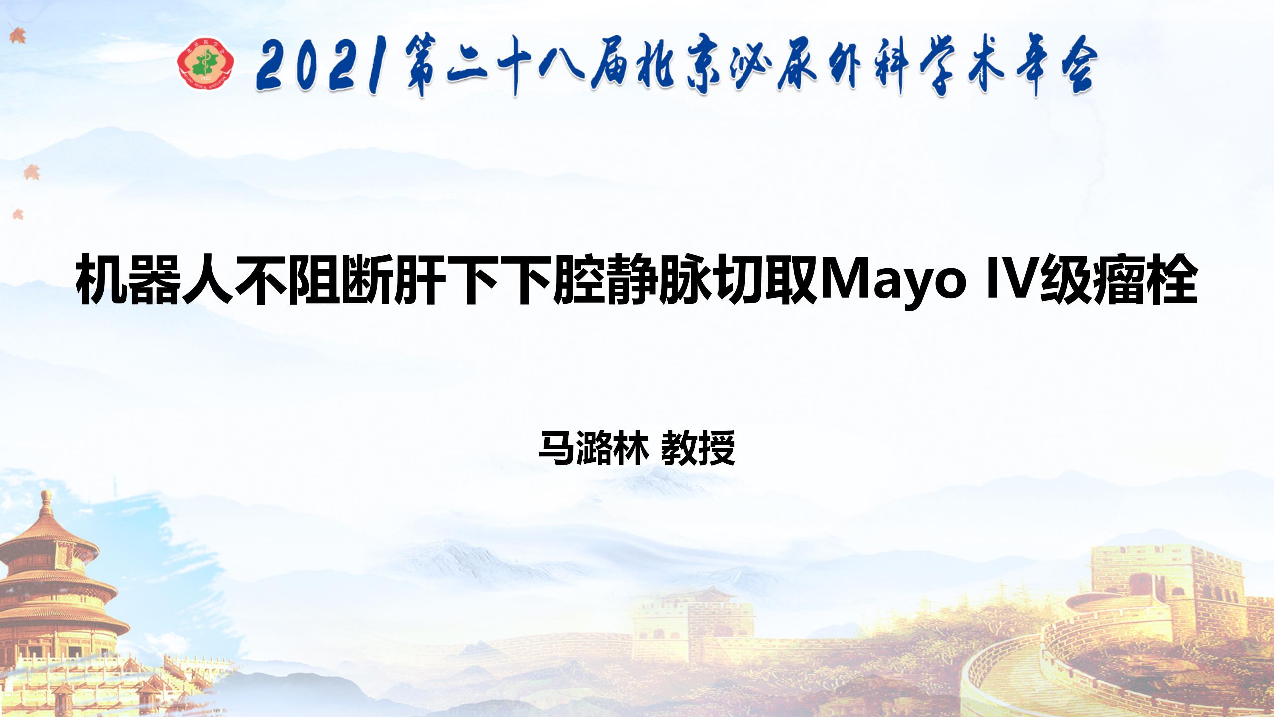 机器人不阻断肝下下腔静脉切取Mayo  IV级瘤栓
