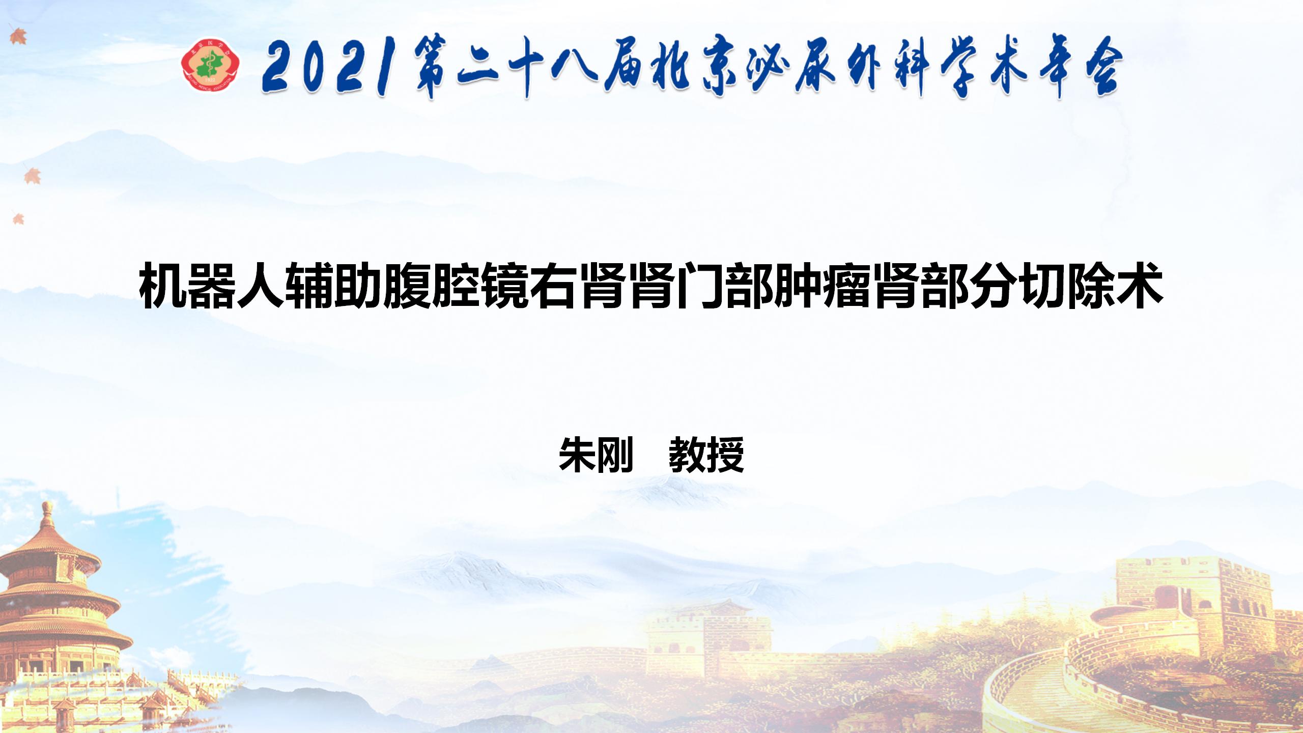 机器人辅助腹腔镜右肾肾门部肿瘤肾部分切除术