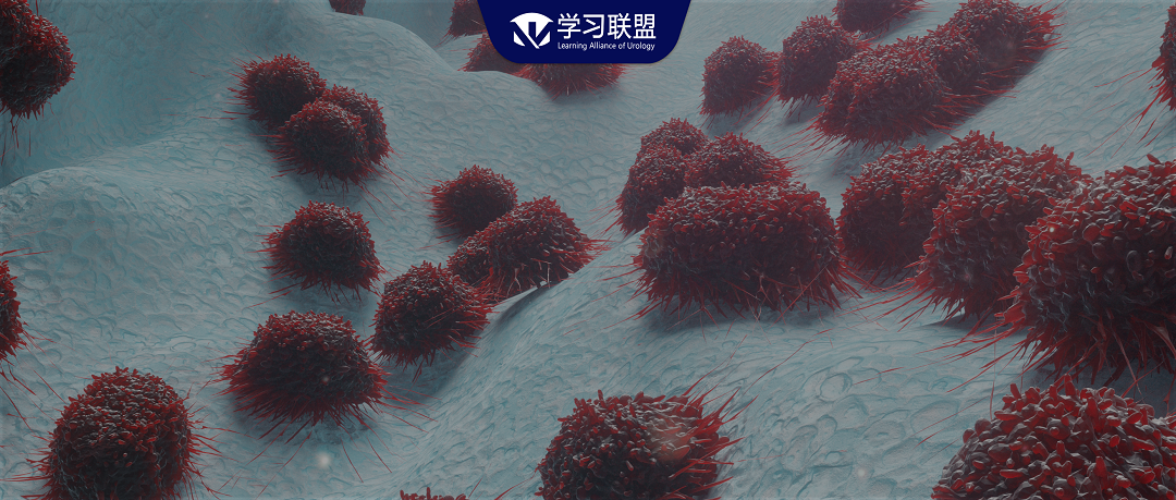 射精后血尿！一种极易误诊的疾病：后尿道海绵状血管瘤