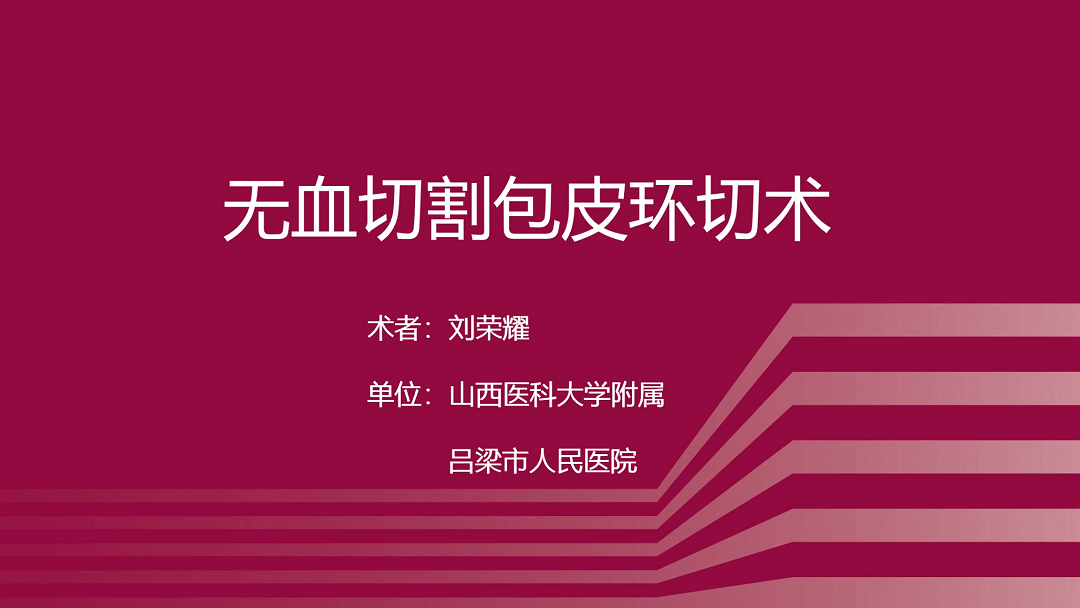 无血切割包皮环切术