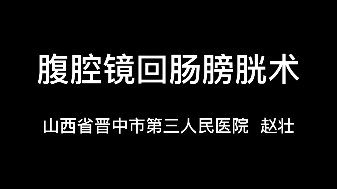 赵壮 | 腹腔镜回肠膀胱术