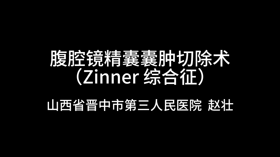 赵壮 | 腹腔镜精囊囊肿切除术（Zinner 综合征）