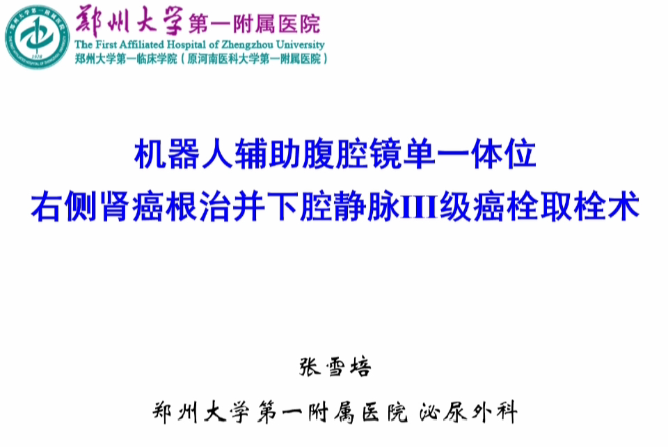 机器人辅助腹腔镜单一体位右侧肾癌根治并下腔静脉Ⅲ级癌栓取栓术