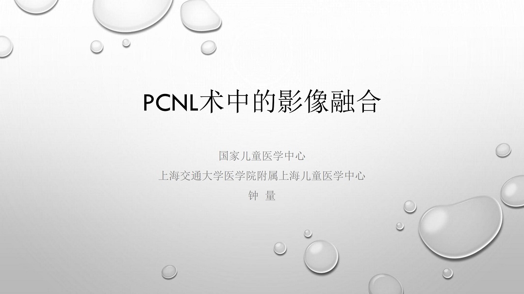钟量 | PCNL术中的影像融合