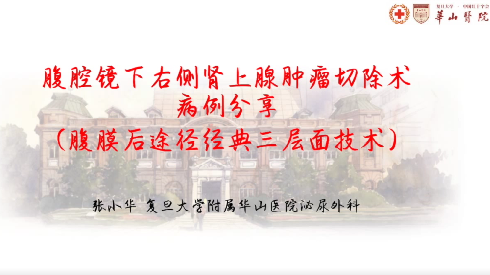 腹腔镜下右侧肾上腺肿瘤切除术（腹膜后途径经典三层面技术）