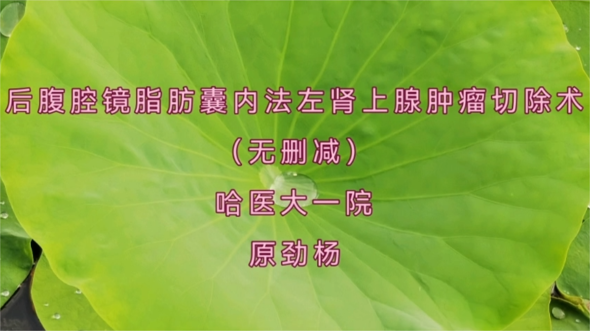后腹腔镜下脂肪囊内法左肾上腺肿瘤切除术