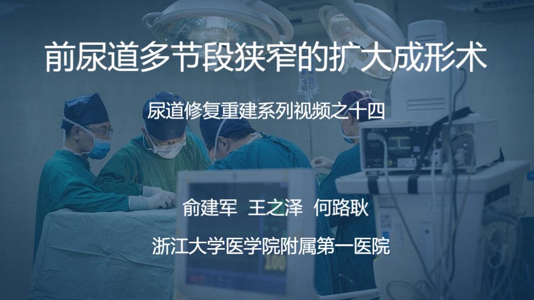尿道修复重建系列视频之十四 | 前尿道多节段狭窄的扩大成形术