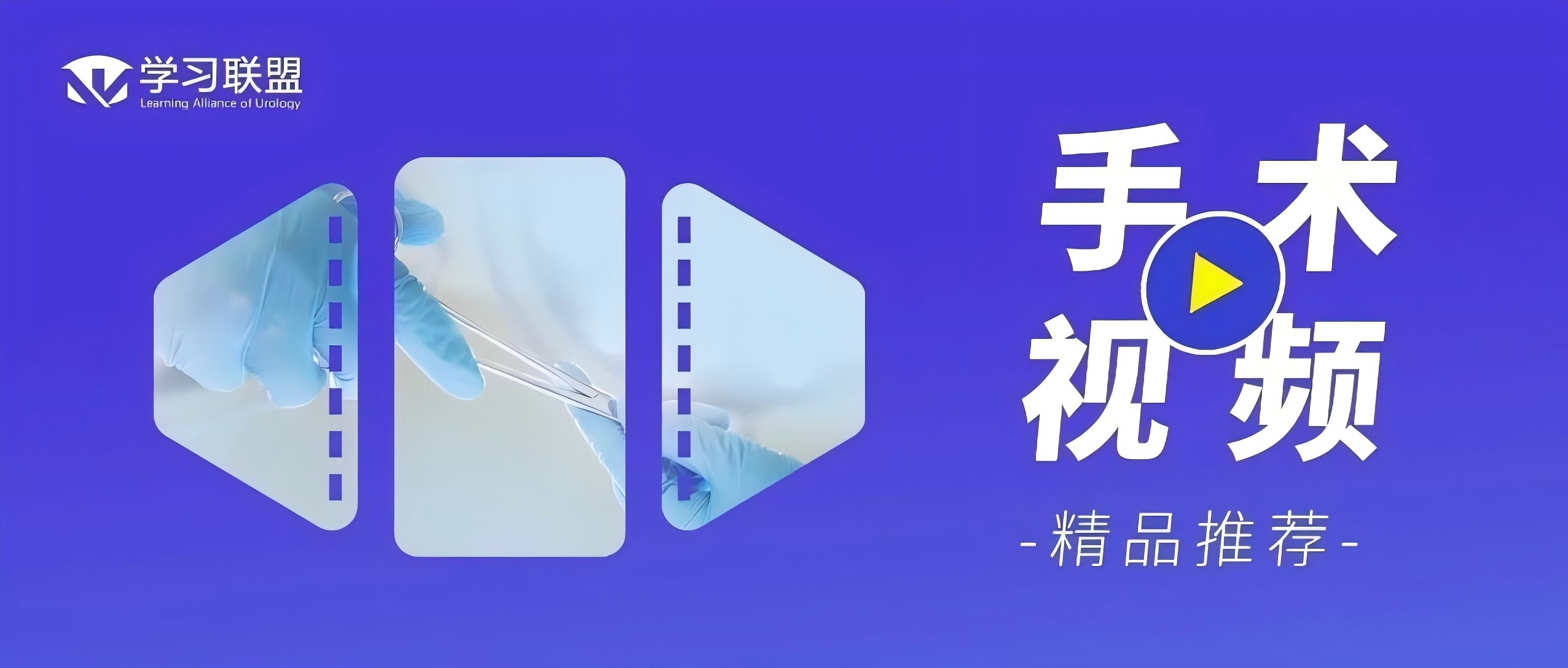 顾昌世 李涛 | 腹腔镜脐尿管瘘切除术-脐整形术